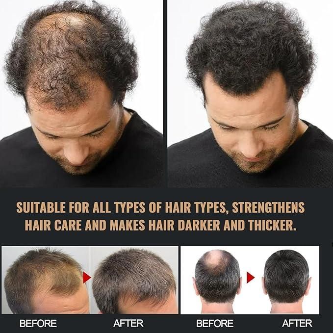 Root Activating Shampoo